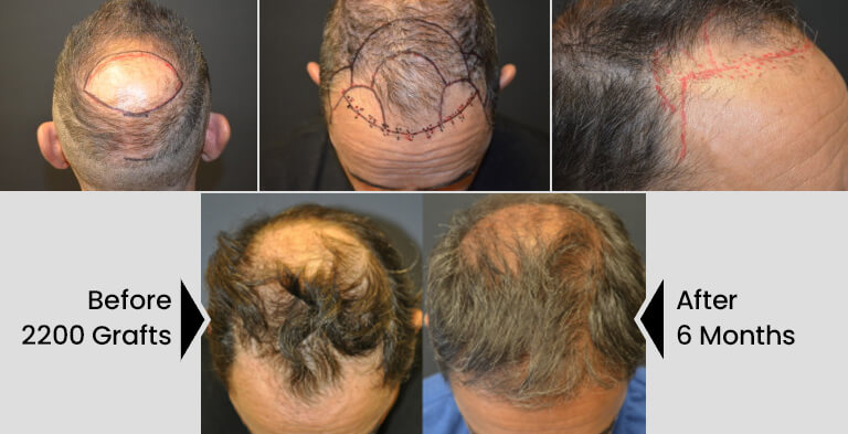 Before and after hair treatments