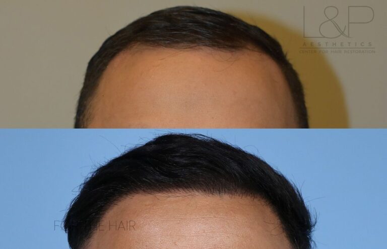 Young Asian in front man before and after