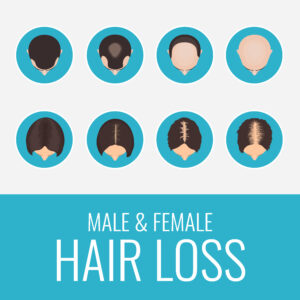 Hair loss in Women at The Center For Hair Restoration